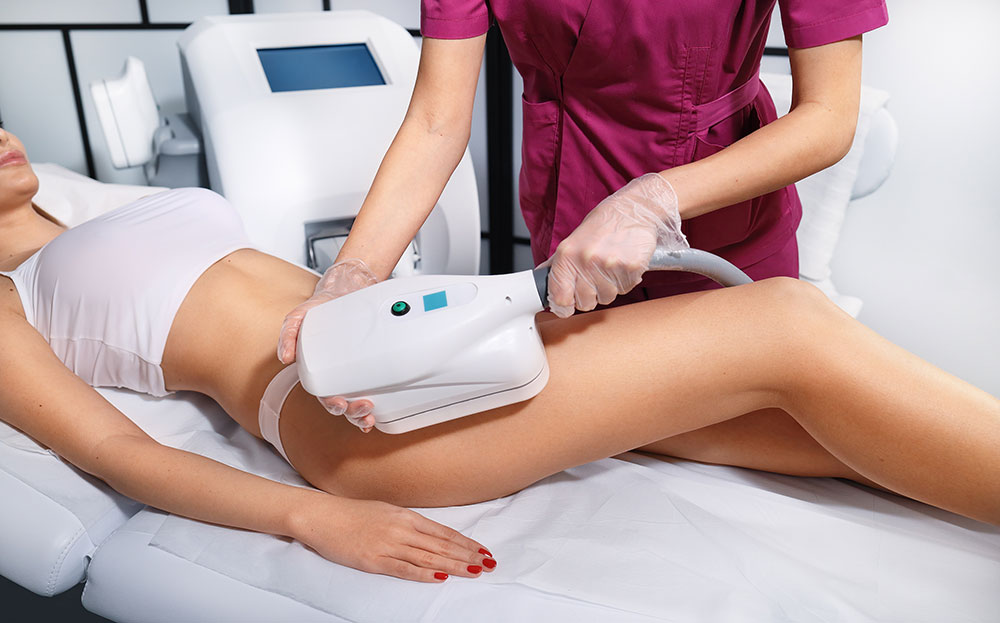 CoolSculpting treatment in Mount Pleasant, SC.